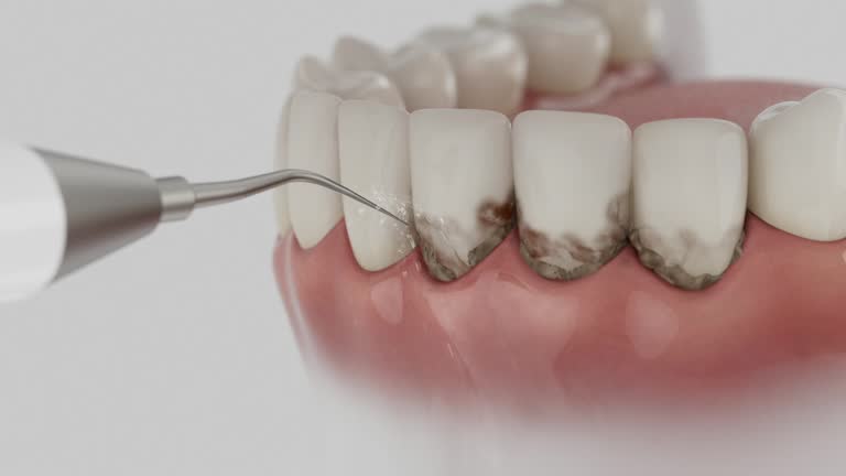 Reliable Dental Implants contractor in Hillandale, MD by Smile Center Dentistry